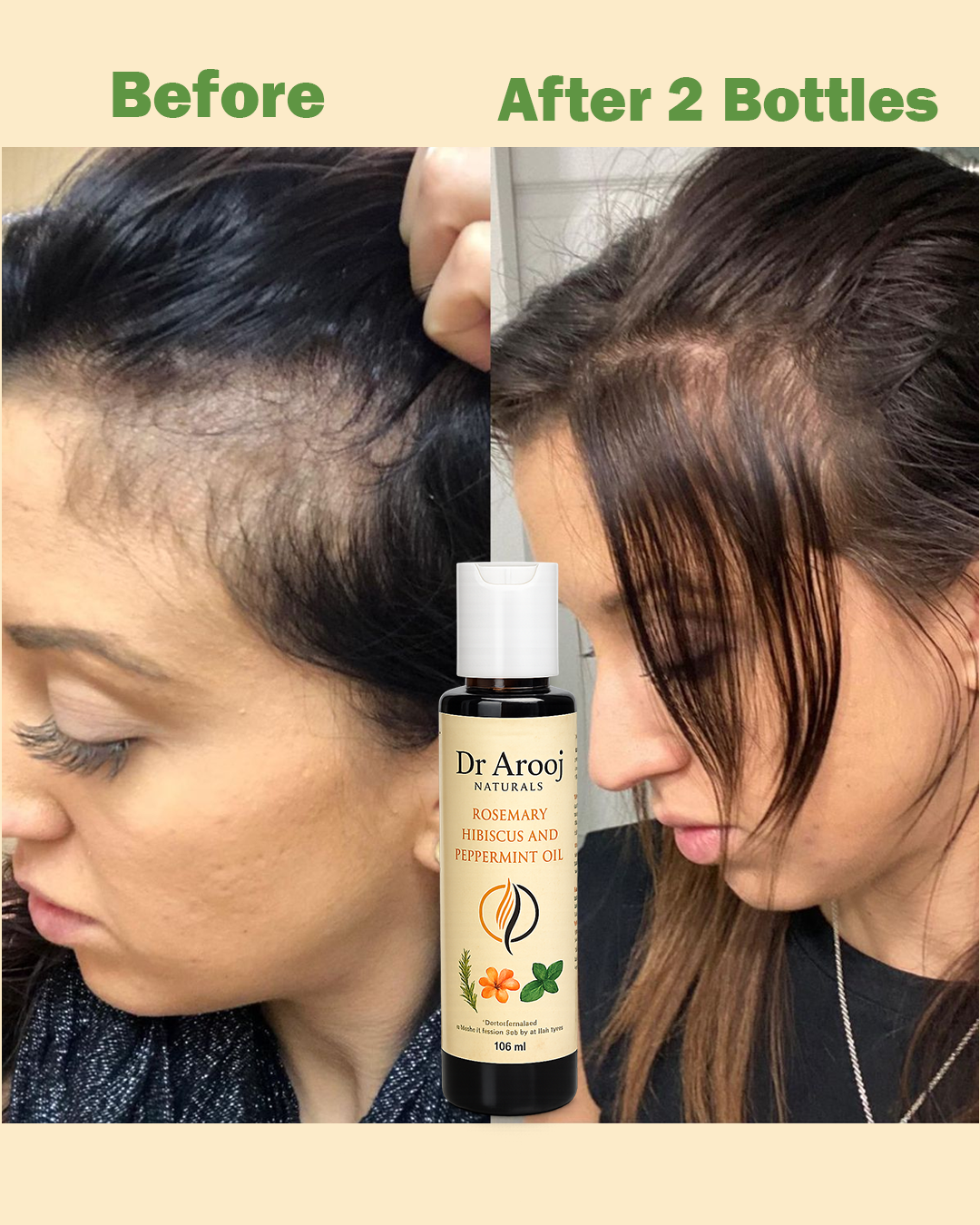 Dr Arooj Naturals Rosemary, Hibiscus & Peppermint Hair Oil
