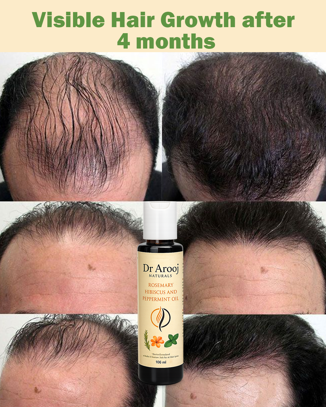 Dr Arooj Naturals Rosemary, Hibiscus & Peppermint Hair Oil